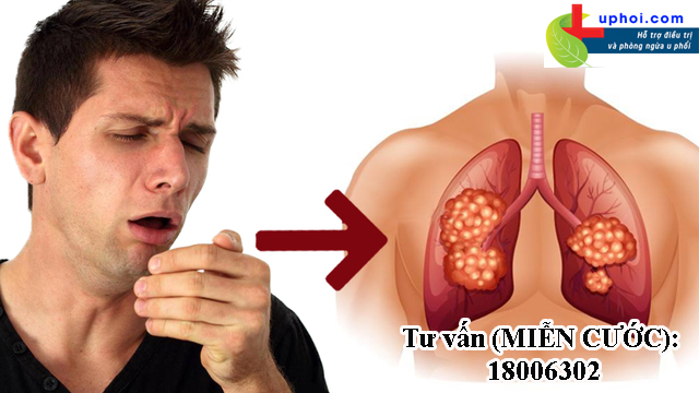 Ung thư phổi căn bệnh nguy hiểm chớ coi thường
