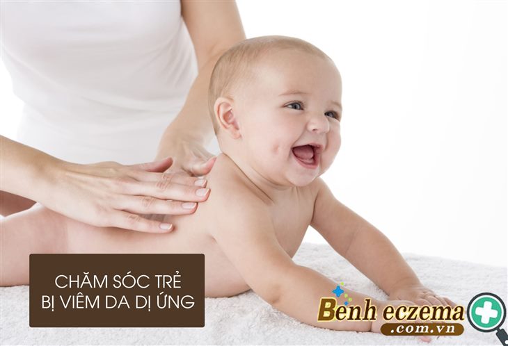 Dưỡng ẩm da cho bé khi bị viêm da dị ứng