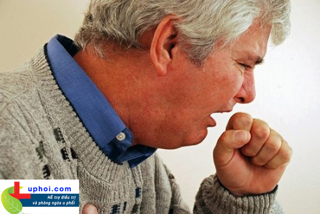 Bệnh u phổi có thể gây nhiều triệu chứng khác nhau