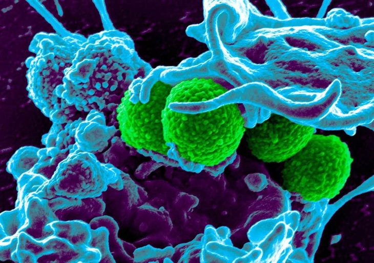    Virus Varicella Zoster gây bệnh thủy đậu