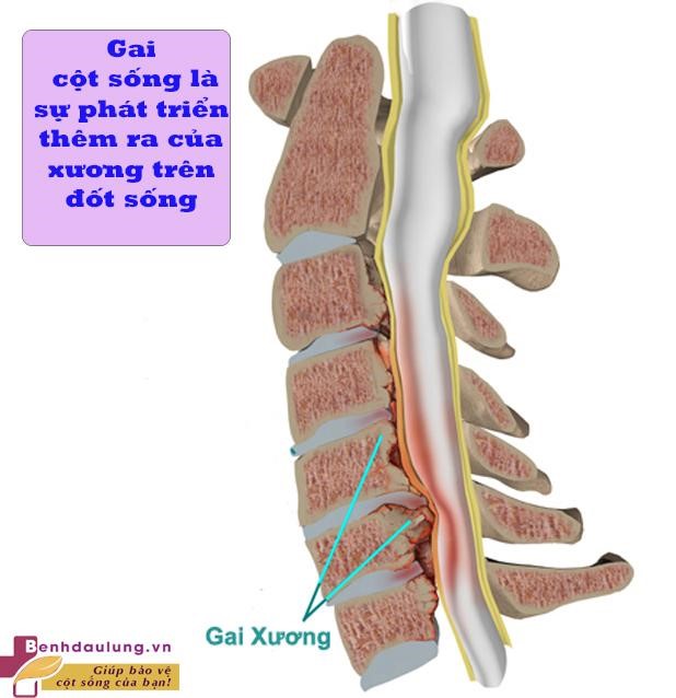 gai-cot-song-la-su-phat-trien-them-ra-cua-xuong-tren-dot-song