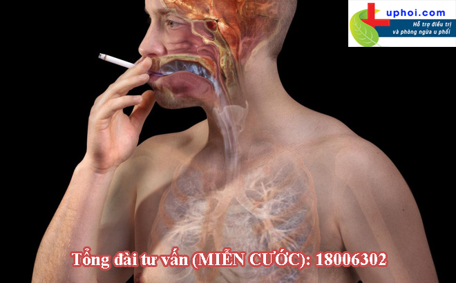Người hút thuốc lá có nguy cơ cao mắc ung thư phổi