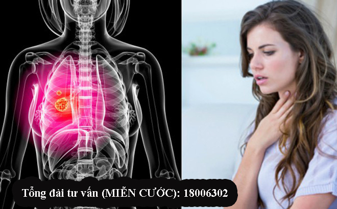U phổi ác tính có nhiều triệu chứng khác nhau