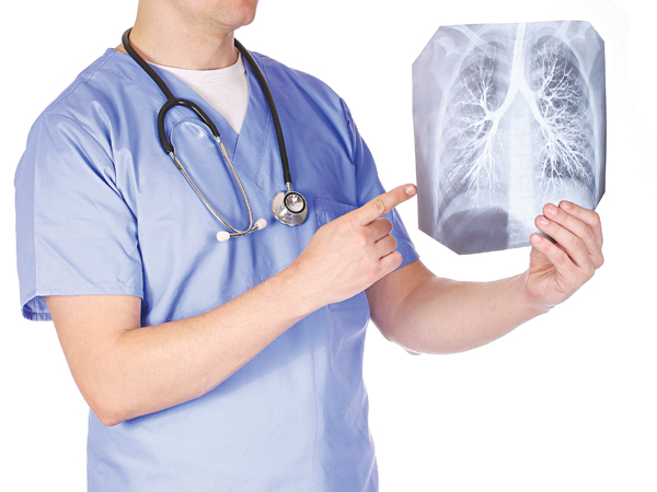 Tái cấu trúc đường thở là nguyên nhân gây viêm phế quản mạn tính