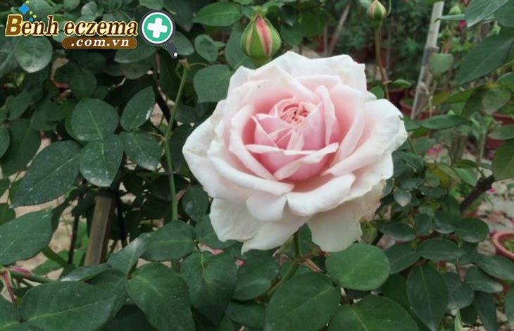  Hoa hồng có thể được dùng để cải thiện bệnh chàm môi