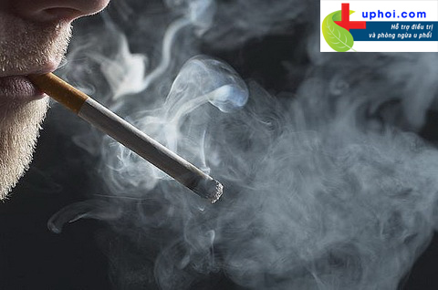 Hút thuốc lá là một trong những nguyên nhân hàng đầu gây ung thư phổi