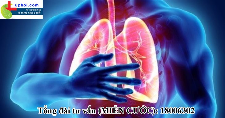 Ung thư phổi là bệnh lý nguy hiểm đến tính mạng