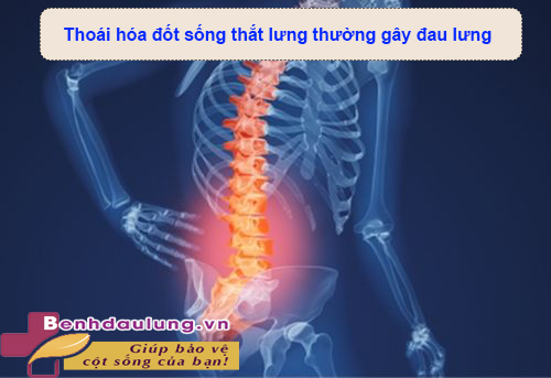 thoai-hoa-dot-song-that-lung-thuong-gay-dau-lung