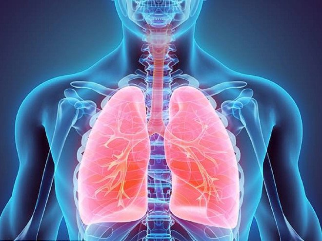 Bệnh lupus ban đỏ gây ra các biến chứng trên phổi