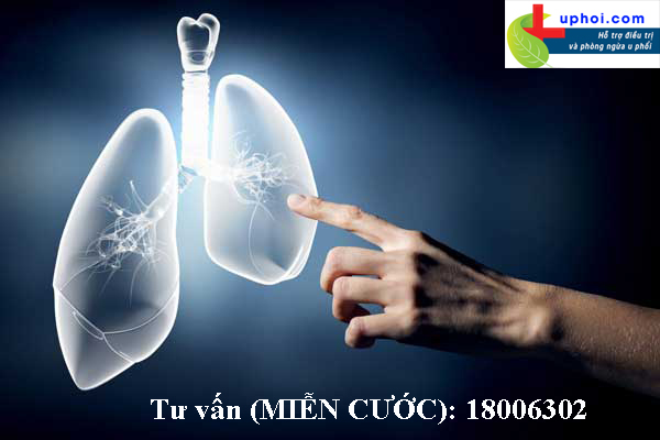 Đặc điểm của bệnh ung thư phổi không tế bào nhỏ là gì?