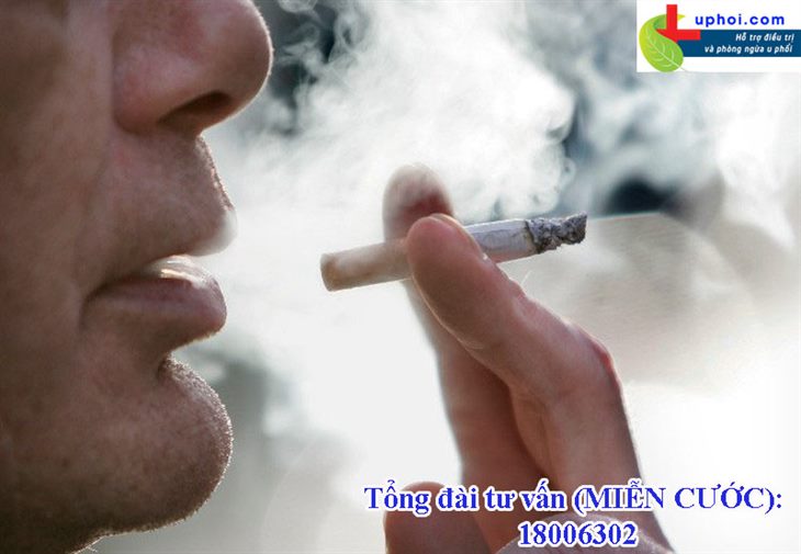 Hút thuốc lá là tác nhân hàng đầu gây ung thư phổi