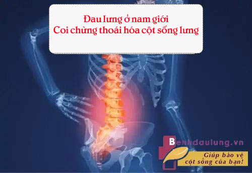 thoai-hoa-dot-song-khien-nguoi-benh-khong-the-cui-khom-lung