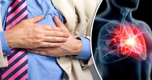 Người mắc bệnh tim mạch dễ bị đột quỵ nhồi máu não