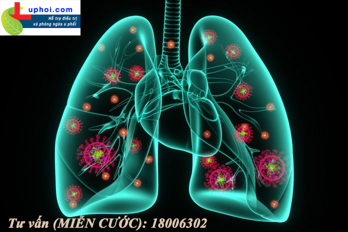 Ung thư phổi là bệnh lý ngày càng có xu hướng tăng nhanh