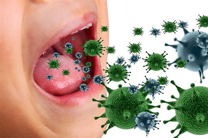 Viêm họng chủ yếu là do virus, vi khuẩn gây ra