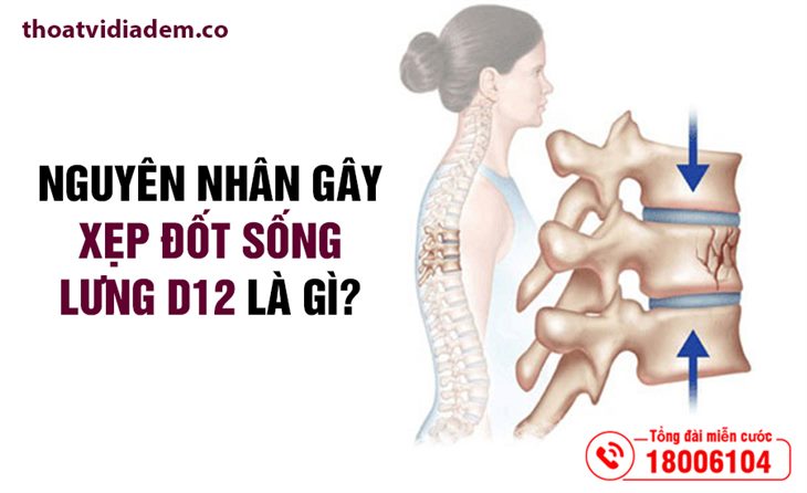 nguyen-nhan-gay-xep-dot-song-lung-d12-la-gi