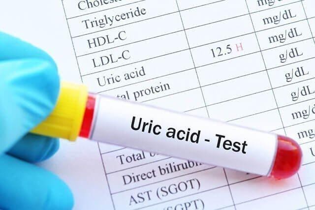 Acid uric trong máu cao là nguyên nhân gây bệnh gout