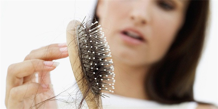 Stress nặng gây ra tình trạng rụng tóc