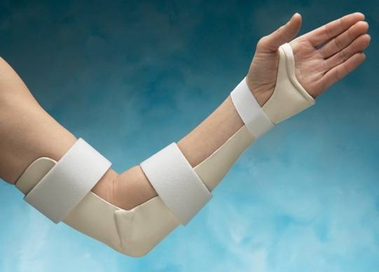 Sử dụng nẹp giúp giảm áp lực lên cánh tay