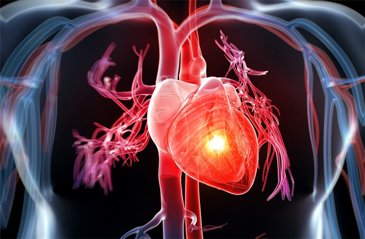 Tăng cholesterol trong máu là nguyên nhân dẫn đến các bệnh lý tim mạc