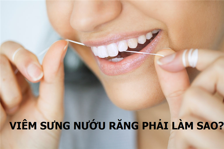   Không vệ sinh răng miệng tốt là nguyên nhân gây viêm sưng nướu răng