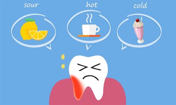   Tình trạng đau răng khiến người mắc khó chịu