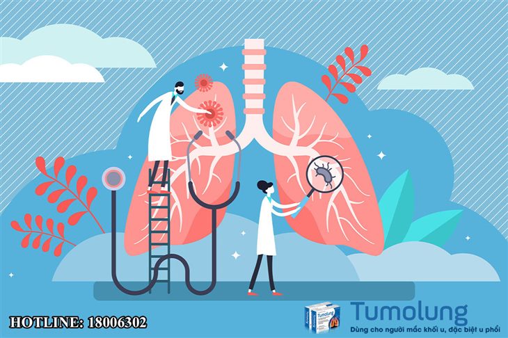 Ung thư phổi là bệnh thường phát hiện ở giai đoạn muộn