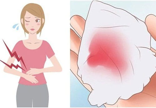 Đau bụng, chảy máu âm đạo bất thường là dấu hiệu bị u nang hoàng thể