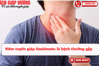 Viêm tuyến giáp Hashimoto là bệnh thường gặp
