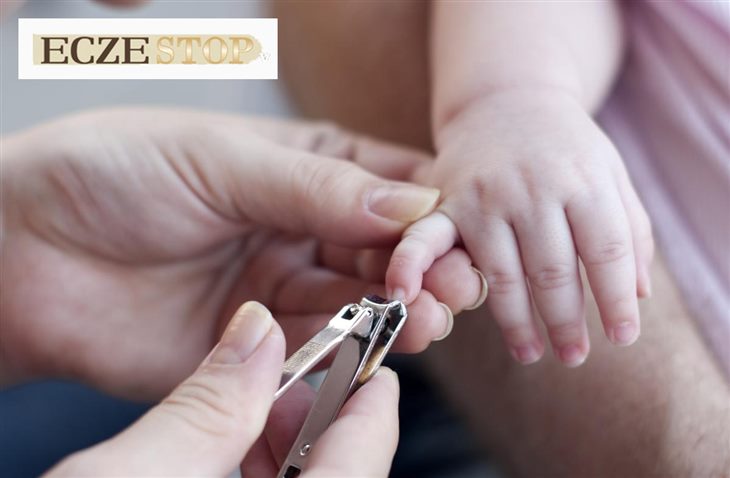  Cần cắt móng tay để hạn chế tổn thương do trẻ vô ý gãi khi bị viêm da cơ địa