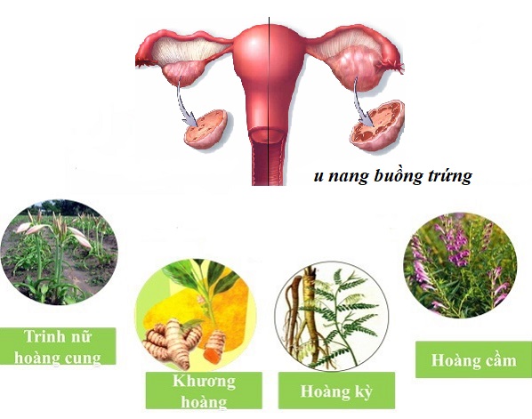 Các thảo dược giúp phòng ngừa và cải thiện u nang buồng trứng hiệu quả