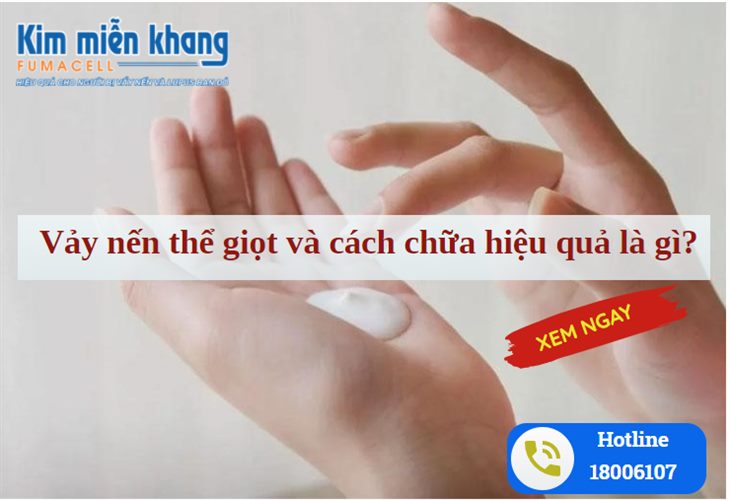 Thuốc bôi chữa vảy nến thể giọt