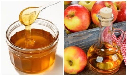 Kết hợp mật ong và giấm táo để chữa viêm amidan