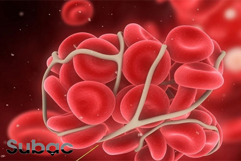 Chảy máu cam khi bị sốt xuất huyết có thể do rối loạn đông máu