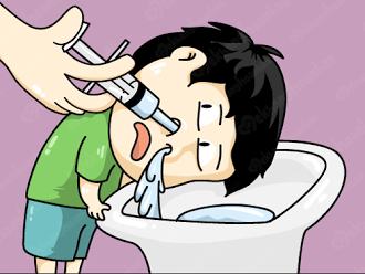Rửa mũi bằng nước muối sinh lý để loại bỏ vi khuẩn, dịch nhầy