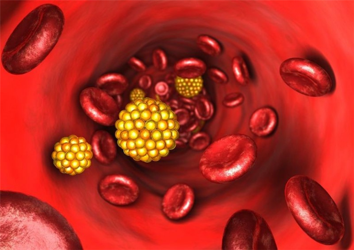 Máu nhiễm mỡ xuất hiện khi các chỉ số mỡ máu trong cơ thể cao vượt ngưỡng cho ph