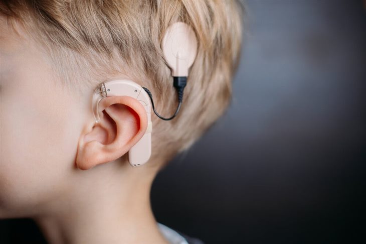 Cấy ghép ốc tai điện tử giúp cải thiện khả năng nghe