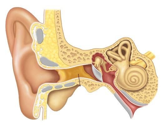 Phẫu thuật chữa nghe kém thường được áp dụng với trường hợp bị tổn thương ở tai trong