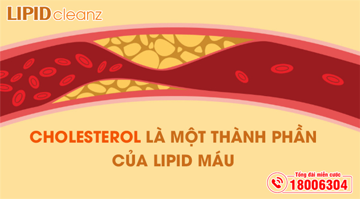 Cholesterol là một thành phần của lipid máu