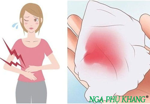 Cần hết sức lưu ý nếu bị đau bụng, chảy máu sau mổ nội soi u nang buồng trứng