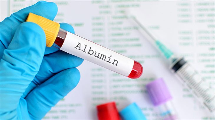  Xét nghiệm albumin huyết thanh để đánh giá chức năng thận