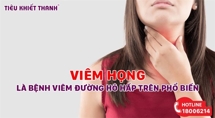 Viêm họng là bệnh đường hô hấp trên phổ biến