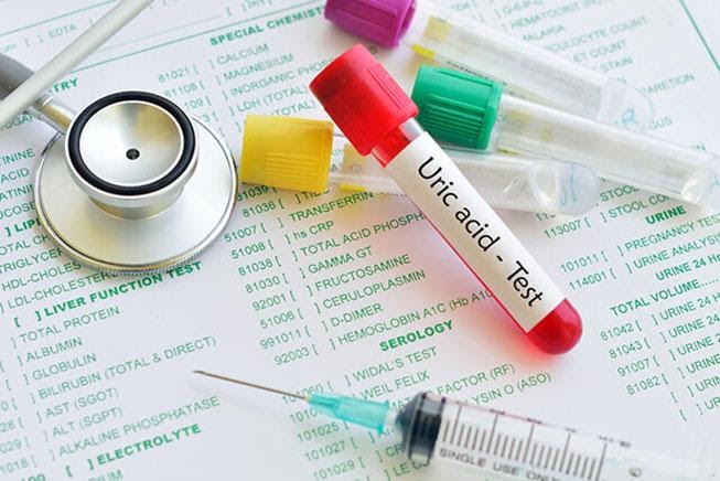 Axit uric trong máu cao là nguyên nhân gây bệnh gút