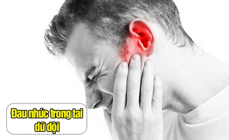 Thủng màng nhĩ dễ gây đau nhức tai