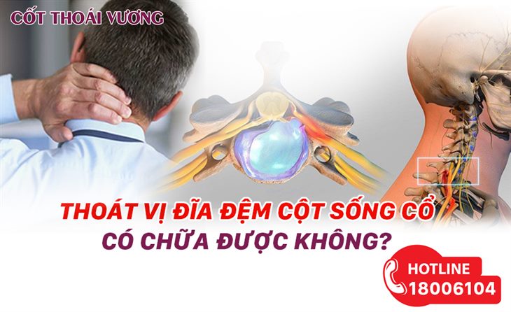 thoat-vi-dia-dem-cot-song-co-chua-duoc-khong
