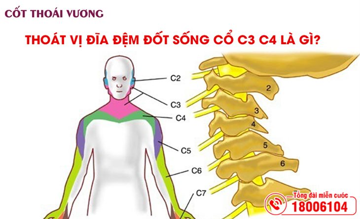 thoat-vi-dia-dem-dot-song-so-c3-c4-la-gi