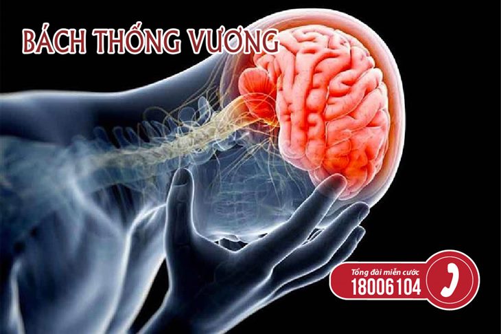 Đau nửa đầu kéo dài có thể gây tổn thương não bộ