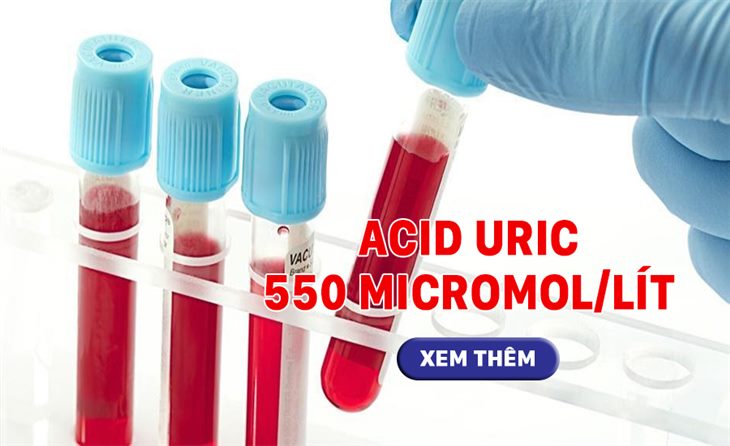 Acid uric máu được đào thải qua thận