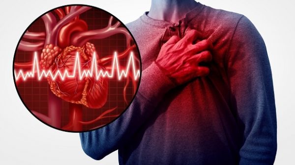   Tình trạng phù do suy thận mạn nếu không kiểm soát tốt sẽ gây biến chứng suy tim