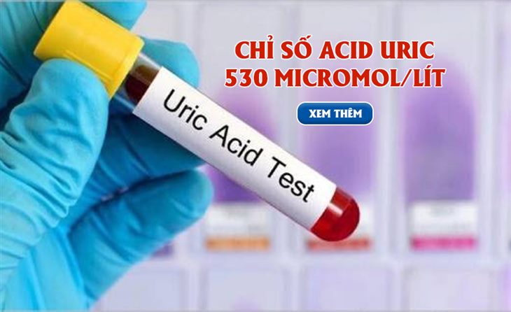 Có nhiều nguyên nhân gây tăng acid uric